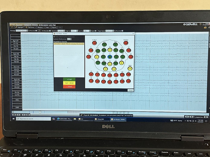 An image showing that electrodes are well placed on the patient